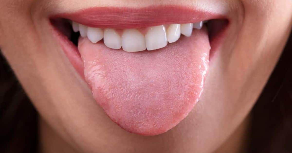 How to Get a Healthy Tongue?