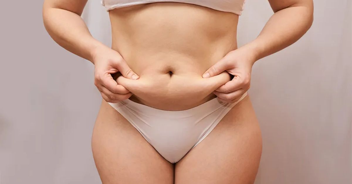 Does Liposuction Have Health Benefits
