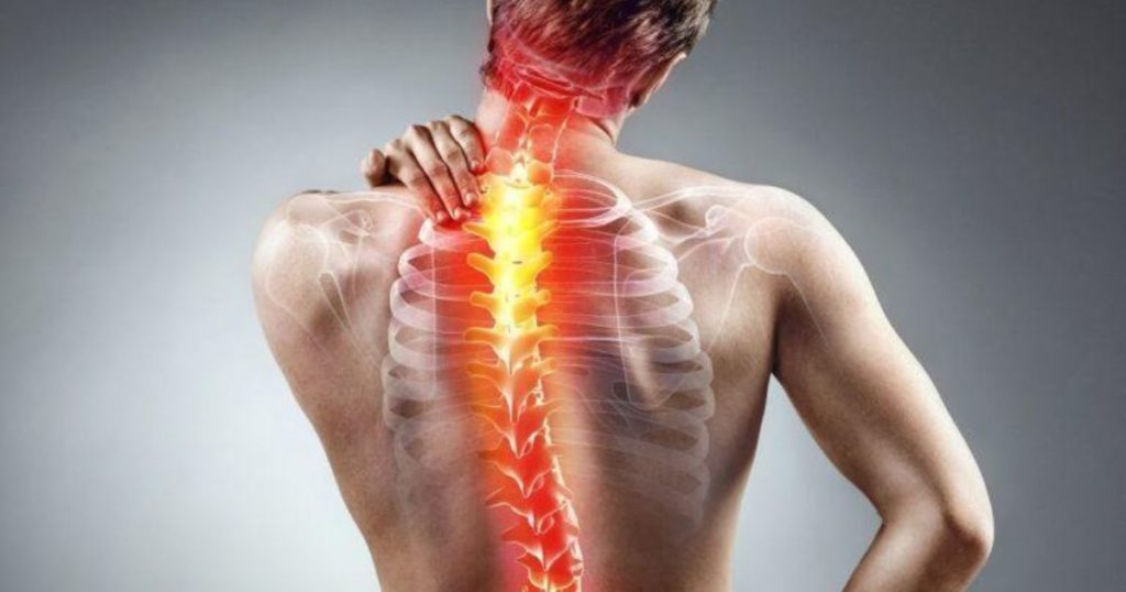 Can You Get An Epidural With Scoliosis? Best Guide