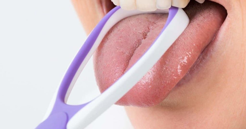 How to Care for Your Tongue